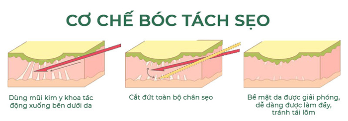 boc tach seo ro