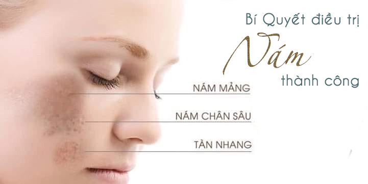 tri nám thành công