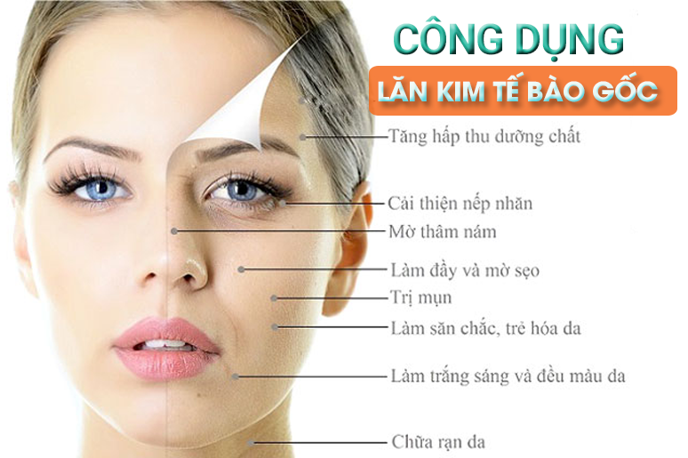 lan kim te bao goc