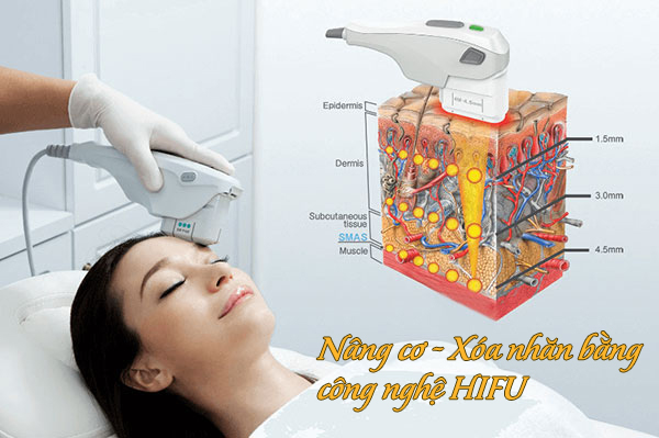 nang co cong nghe hifu