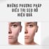 Diode Laser và OPT   – Công nghệ triệt lông nào hiệu quả hơn?